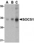 SOCS1 Antibody (C-Terminus)